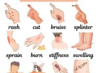 “受伤”的不同英语表达