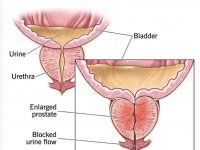 老年男性尿频的原因是什么？