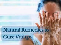 治疗白癜风和所有皮肤病的疗法！