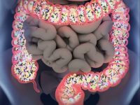 你的肠道正在杀死你