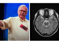 关于大脑衰老的最大谎言