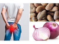 痔疮的自然疗法