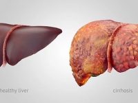 水飞蓟的叶子和根可以修复受损的肝脏🍀💚