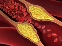 ❤️让您的心脏和血管自然清洁！ ❤️