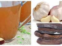 预防或降低中风风险的最佳方法是什么？