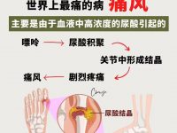 为什么男生比女生更容易「痛风」？