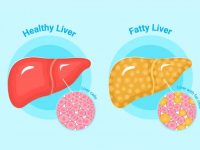 8 种有助于肝脏排毒的饮食习惯