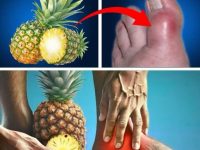 🍍菠萝,治疗痛风疼痛的良方!