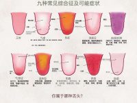 你的舌头能告诉你健康状况的一切