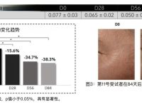 红光疗法在短短3个月内使皱纹深度减少了38%